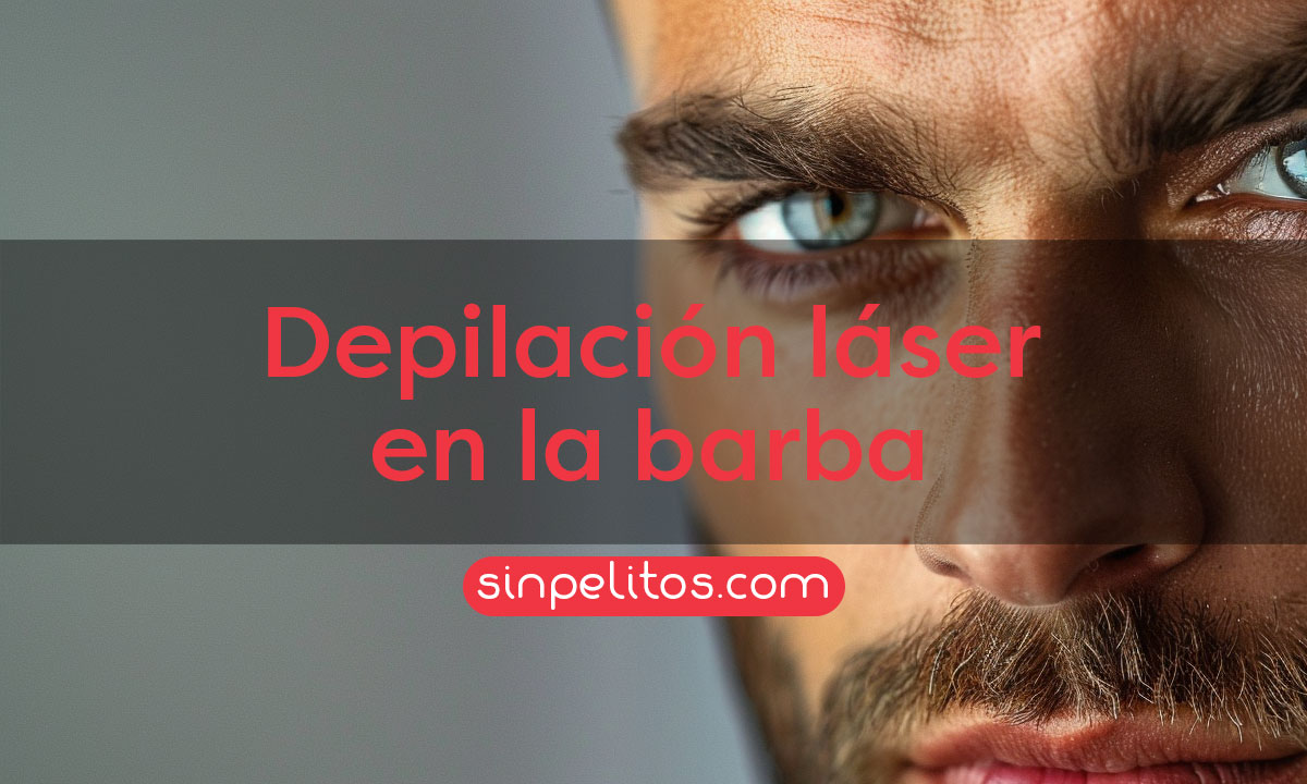 Depilación láser en barba